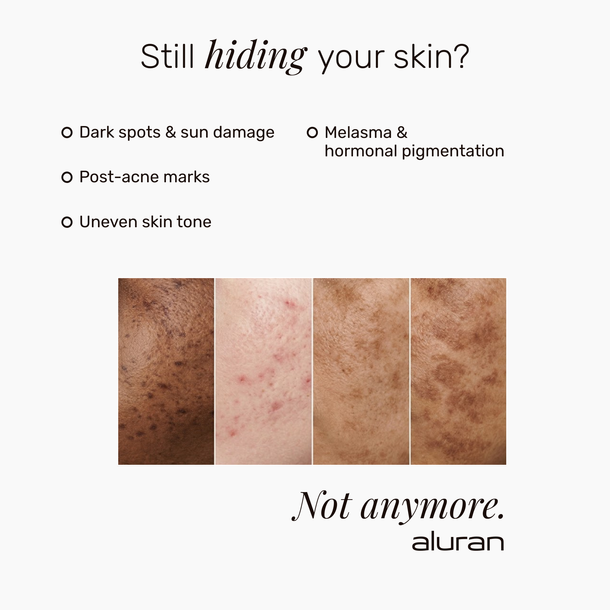 FADE SERUM | Pigment Perfecting